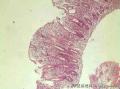 结肠黏膜图4