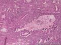 子宫内膜组织图44