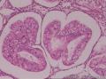 子宫内膜组织图13