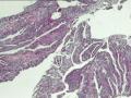 直肠粘膜图4