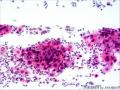 宫颈涂片图27