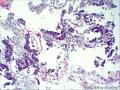 直肠粘膜组织图31