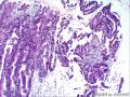 直肠粘膜组织图23