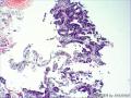 直肠粘膜组织图30