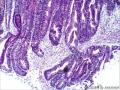 直肠粘膜组织图25