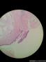 内见胶冻样物，组织被覆纤毛柱状上皮，囊肿位于肾门图7