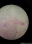 内见胶冻样物，组织被覆纤毛柱状上皮，囊肿位于肾门图6