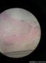内见胶冻样物，组织被覆纤毛柱状上皮，囊肿位于肾门图10