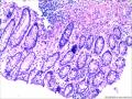 直肠组织图6