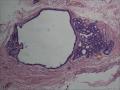 睾丸鞘膜，请教这些是什么图2
