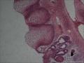 膀胱三角区粘膜图13