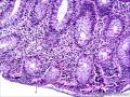 直肠黏膜组织图22