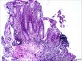 直肠黏膜组织图19
