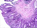 直肠黏膜组织图17
