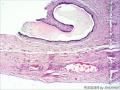 左睾丸鞘膜图17