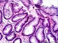 胃窦粘膜组织图22