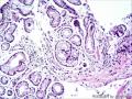 胃窦粘膜组织图11