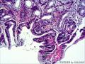 胃窦粘膜组织图7
