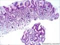 胃窦粘膜组织图5