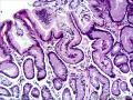 胃窦粘膜组织图13