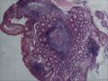 回肠粘膜图1