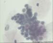 请教41岁TCT，成团的裸核细胞团史颈管细胞吗？图9