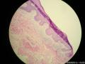 阴茎系膜赘生物图3