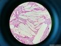 胆囊浆膜层的如此结构如何解释？图3