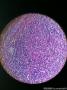 球结膜肿物图6