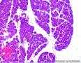 求看胰腺组织切片   sd大鼠图6