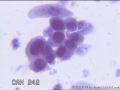 请大神看看这些细胞    患者HPV分型是阴性图18