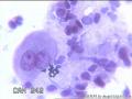 请大神看看这些细胞    患者HPV分型是阴性图2