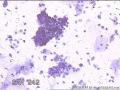 请大神看看这些细胞    患者HPV分型是阴性图8