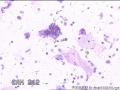 请大神看看这些细胞    患者HPV分型是阴性图23