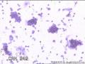 请大神看看这些细胞    患者HPV分型是阴性图21