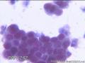 请大神看看这些细胞    患者HPV分型是阴性图28