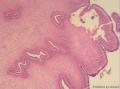 一个肠道寄生虫，请老师们指导一下是什么寄生虫图5