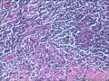 肠镜标本，看淋巴细胞是否有问题图9