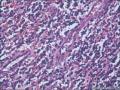 肠镜标本，看淋巴细胞是否有问题图3