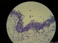 膀胱粘膜电切图3