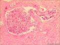 前列腺组织图9