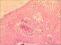 前列腺组织图8