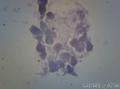 肾囊肿脱落细胞 这是什么细胞？图4