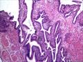 胆囊，浆膜面这些细胞是组织细胞吗图2