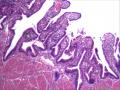 胆囊，浆膜面这些细胞是组织细胞吗图1