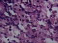 胆囊，浆膜面这些细胞是组织细胞吗图5