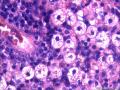 胆囊，浆膜面这些细胞是组织细胞吗图8