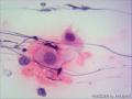 宫颈细胞学检查图4