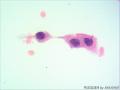 宫颈细胞学检查图6