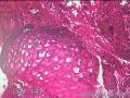 子宫颈内膜组织图12